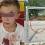 Sbatte contro la porta in ferro del campetto, bimbo di 8 anni al pronto soccorso [VIDEO]