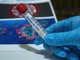 Coronavirus, sono 313 i nuovi positivi in Liguria dove non si arresta la crescita dei ricoveri Coronavirus, sono 313 i nuovi positivi in Liguria dove non si arresta la crescita dei ricoveri