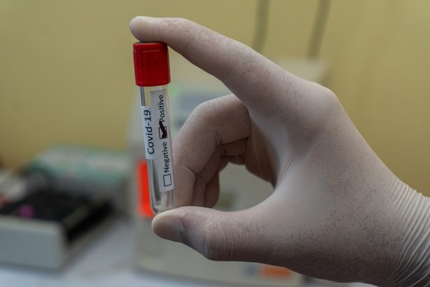 Coronavirus in Piemonte: 1548 nuovi positivi, la metà asintomatici. I ricoverati salgono a 125 Coronavirus in Piemonte: 1548 nuovi positivi, la metà asintomatici. I ricoverati salgono a 125