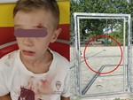 Sbatte contro la porta in ferro del campetto, bimbo di 8 anni al pronto soccorso [VIDEO]