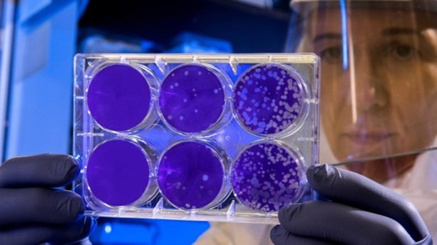 Altri due morti per il coronavirus nell'astigiano. Più positivi (45) che nuovi guariti (38) Altri due morti per il coronavirus nell'astigiano. Più positivi (45) che nuovi guariti (38)