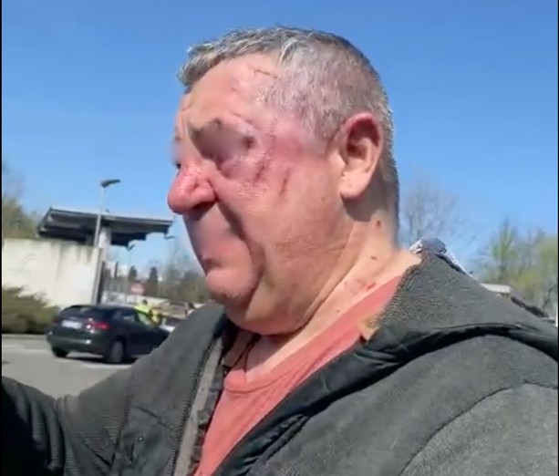 Rapina al suk della Colletta: uomo di 57 anni cade e viene derubato. Portato al Giovanni Bosco