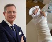 Aggredito da un bandito per l'orologio da 3mila euro, un mese di prognosi per l'ingegner Crescimanno